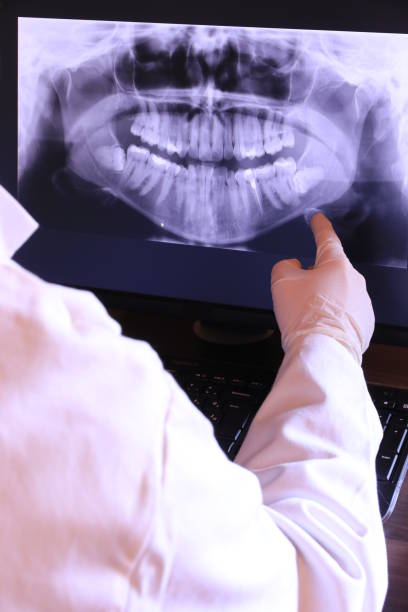Best Emergency Root Canal Treatment in Natchez, MS
